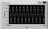 100Hz.PNG