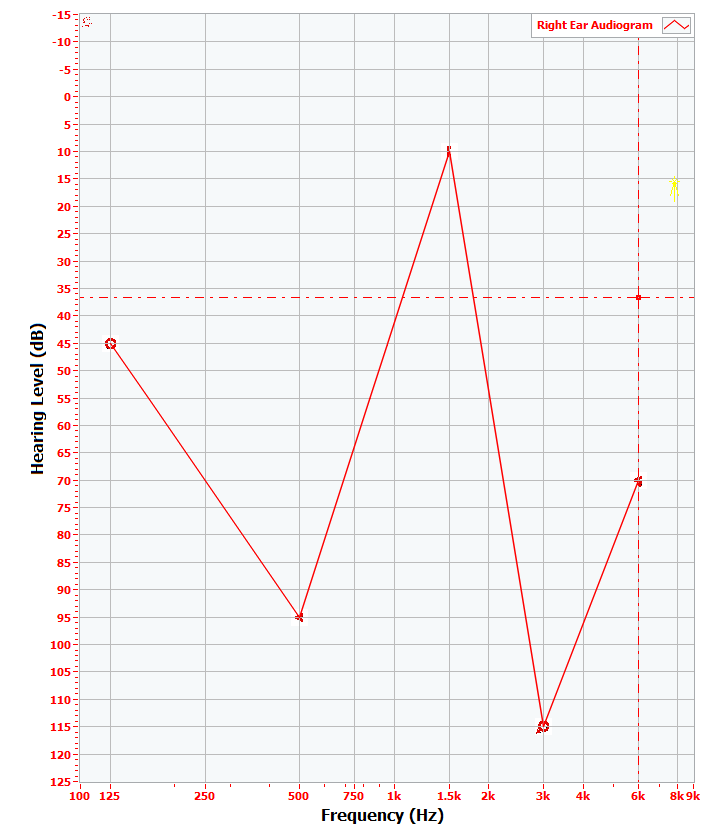 altenbach_0-1742055019258.png