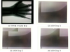 1424 X-ray image.png
